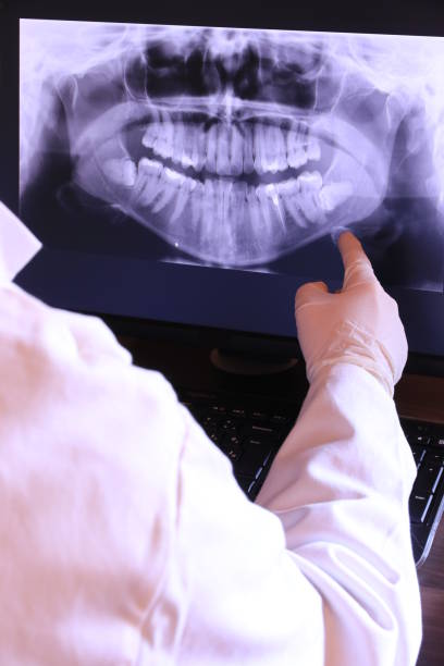 Best Emergency Root Canal Therapy in Yellow Springs, OH