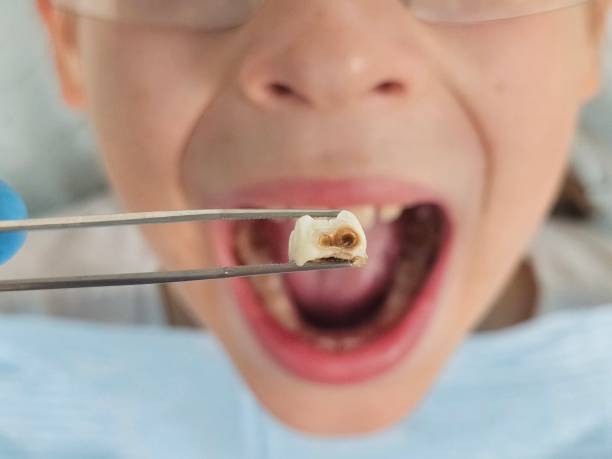 Professional Emergency Dental Service in OH
